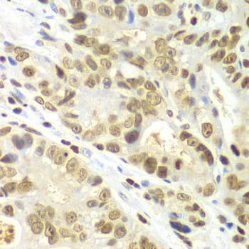 Polyclonal Rabbit anti-Human IKBKB / IKK2 / IKK Beta Antibody (IHC, IF, WB)