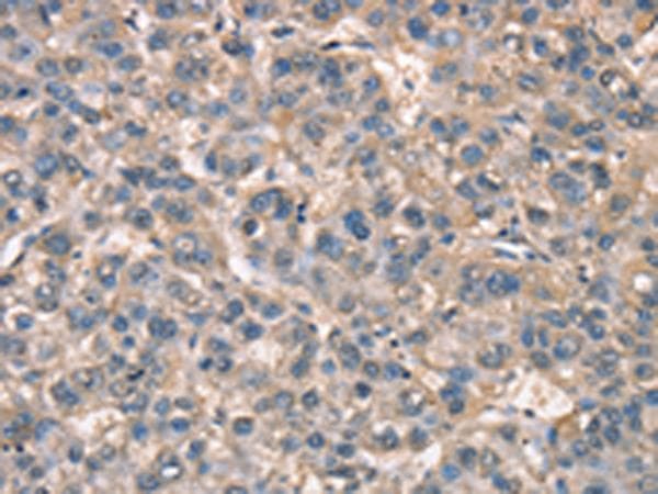 ZFYVE19 Antibody