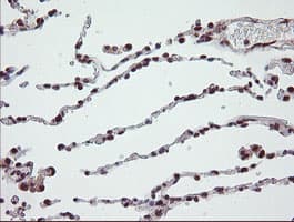 NUMB Antibody (clone OTI4F3, Carrier-free)