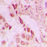 PARK7 / DJ-1 Antibody (Internal)