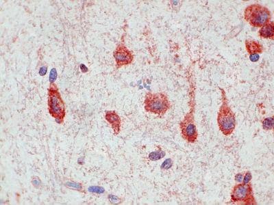 CHEMR23 / CMKLR1 Antibody (clone 1A7)