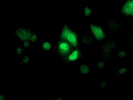 TP53 / p53 Antibody (clone OTI2H6, Carrier-free)