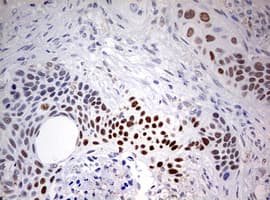 FEN1 Antibody (aa117-380, clone OTI1F3)