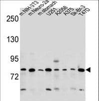 DCBLD2 Antibody (aa538-567)