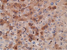 KHK / Ketohexokinase Antibody (clone OTI3D1)