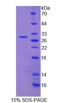 Human NMT2 Protein (Recombinant His, N-Terminal)