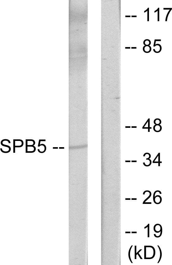 SERPINB5 / Maspin Antibody