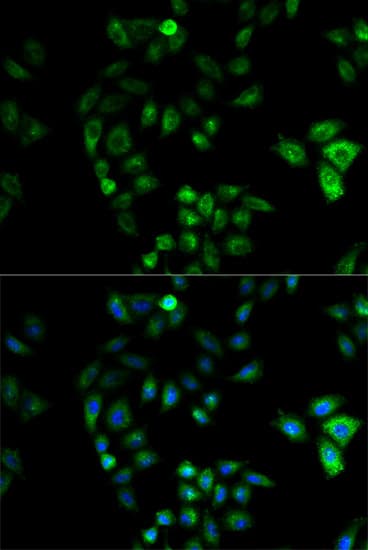 HSD17B2 Antibody