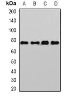 Polyclonal Rabbit anti-Human SP110 Antibody (WB)