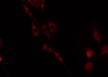 LGR6 Antibody