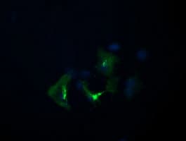 IHC-plus™ Monoclonal Mouse anti-Human DIXDC1 Antibody (clone 6B6, IHC, IF, WB)