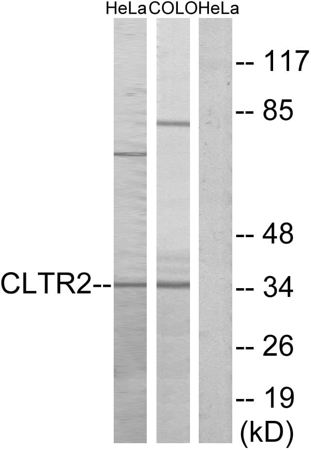 CYSLT2 / CYSLTR2 Antibody (aa281-330)