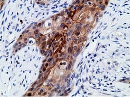 EPHX2 / Epoxide Hydrolase 2 Antibody (clone OTI1H5)