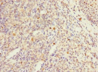 PTPN7 / HEPTP Antibody