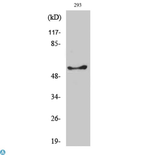 GK / Glycerol Kinase Antibody