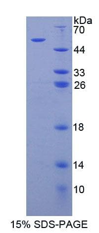 Human ARSB / Arylsulfatase B Protein (Recombinant His, N-Terminal)