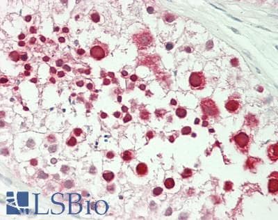 IHC-plus™ KPNA2 / Importin Alpha 1 Antibody (aa475-C-term)