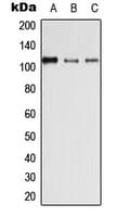 IHC-plus™ DSG4 / Desmoglein 4 Antibody (Internal)