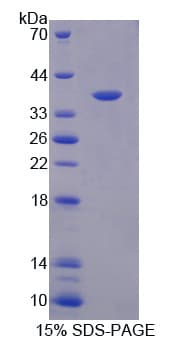 Human OAT Protein (Recombinant His)
