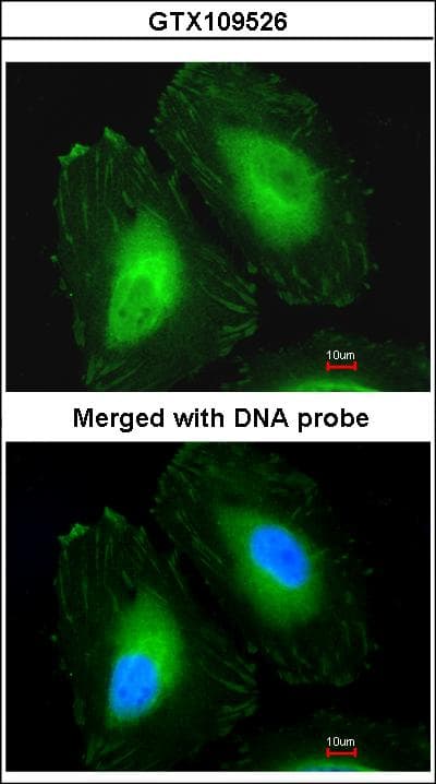 CRYBA4 Antibody (aa1-196)