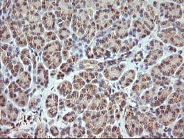 RARRES1 Antibody (clone OTI1D2, Carrier-free)