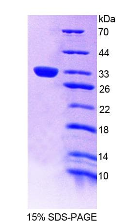 Human TEC Protein (Recombinant His-T7)