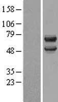 DCDC2 Protein (Over-Expression Lysate Myc-DDK (Flag))