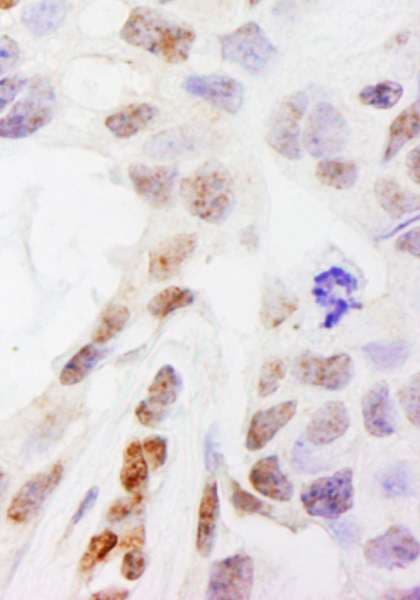 Polyclonal Rabbit anti-Human DHX38 Antibody (aa1150-1200, IHC)