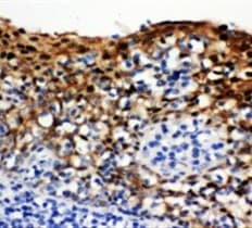 SFN / Stratifin / 14-3-3 Sigma Antibody (aa140-156)
