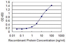 Monoclonal Mouse anti-Human ZNF138 Antibody (clone 4D11, IHC, WB)
