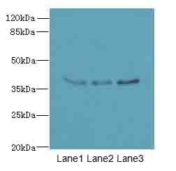 Polyclonal Rabbit anti-Human LRTM1 Antibody (IHC, WB)