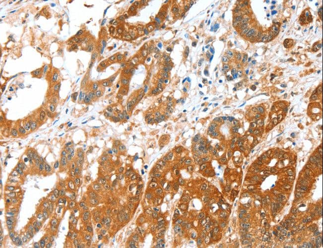 ALDH5A1 Antibody