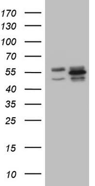 YBX1 / YB1 Antibody (clone OTI7B4)