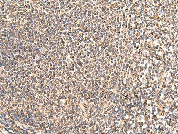 NEGR1 / Neurotractin Antibody