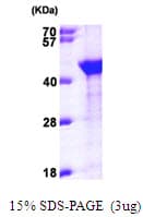 Human AIMP1 / EMAP II Protein (Recombinant His)