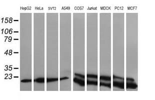 Monoclonal Mouse anti-Human UBE2G2 Antibody (clone OTI1D2, IHC, IF, WB)