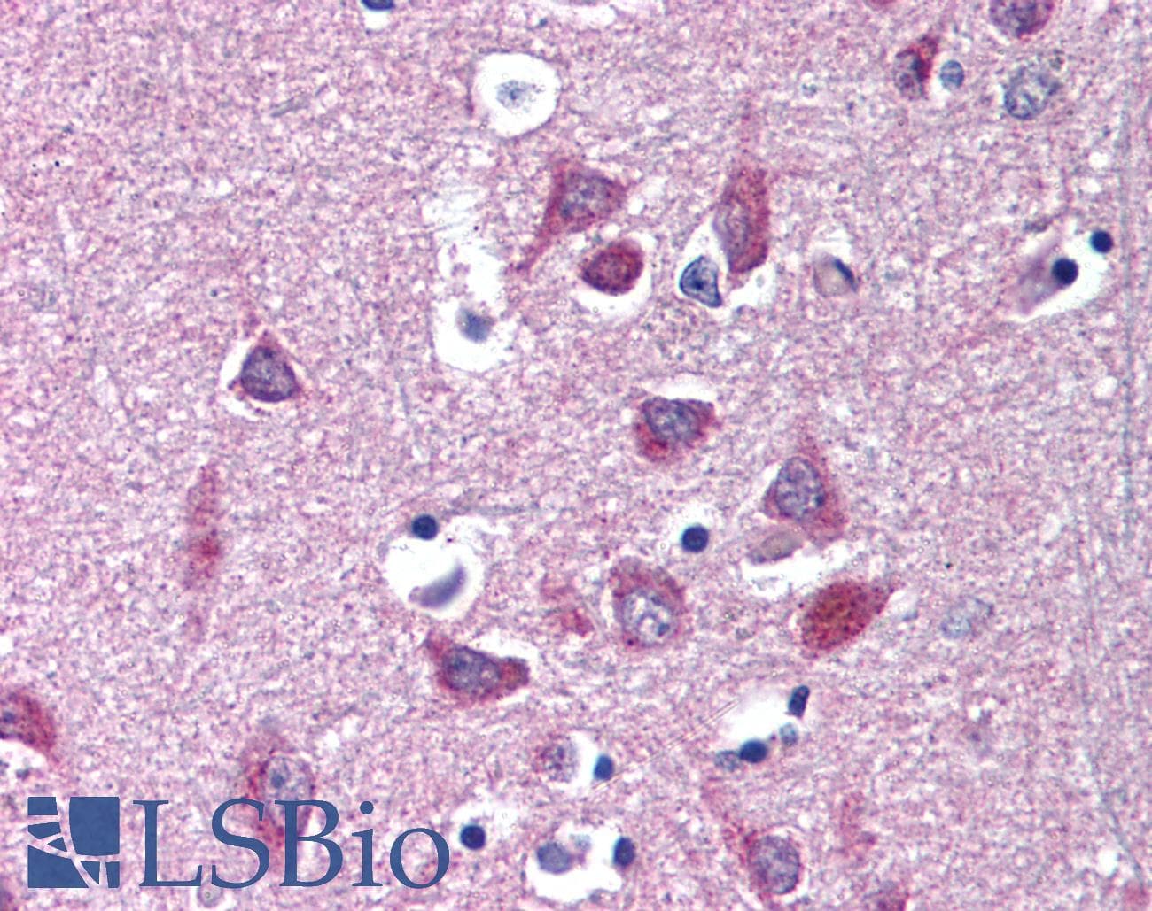 IHC-plus™ Polyclonal Rabbit anti-Human KCNA3 / Kv1.3 Antibody (Internal, IHC)