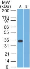 Osteonectin / SPARC Antibody (aa46-63)