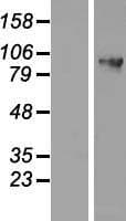 DDX27 Protein (Over-Expression Lysate Myc-DDK (Flag))