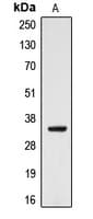 CYB5R3 / B5R Antibody (Internal)