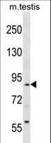 Polyclonal Rabbit anti-Human RTN1 / Reticulon 1 Antibody (aa198-227, WB)