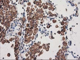 IHC-plus™ SNX8 Antibody (clone 4F8)