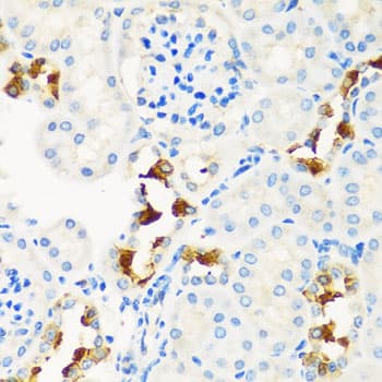 Polyclonal Rabbit anti-Human CPT2 Antibody (IHC, IF, WB)