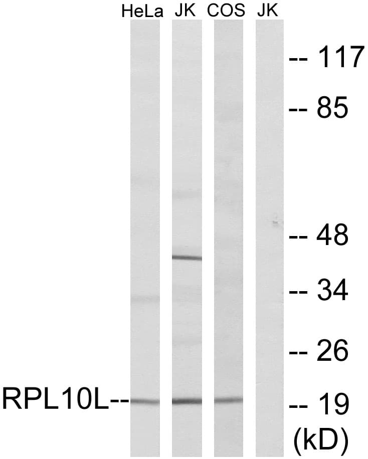 Polyclonal Rabbit anti-Human RPL10 / Ribosomal Protein L10 Antibody (aa151-200, WB)