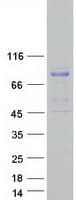 Human DMD / Dystrophin Protein (Recombinant Myc-DDK (Flag))