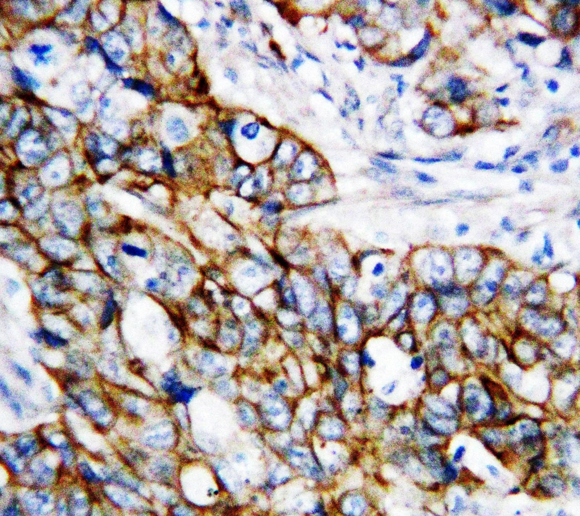 Polyclonal Rabbit anti-Human CTNNB1 / Beta Catenin Antibody (aa1-19, IHC, WB)