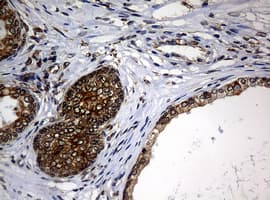 NBN / Nibrin Antibody (clone OTI3A2)