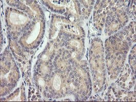 Monoclonal Mouse anti-Human MDM4 / MDMX Antibody (clone 3B9, Carrier-free, IHC, IF, WB)