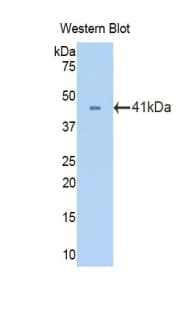OXTR / Oxytocin Receptor Antibody (aa272-377, Biotin)