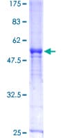 Human DCK / Deoxycytidine kinase Protein (Recombinant GST)